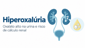 Hiperoxalúria com oxalato alto na urina e risco de cálculo renal